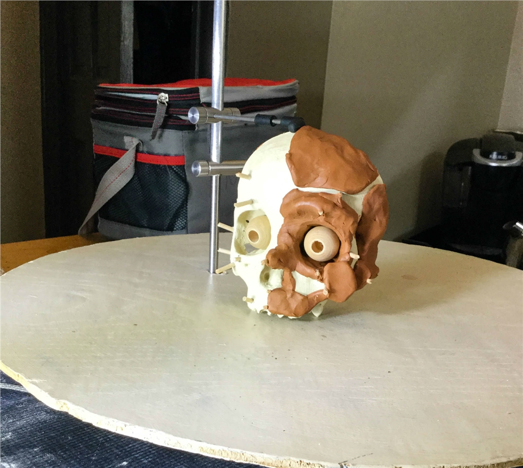 3D列印人類(lèi)頭骨模型