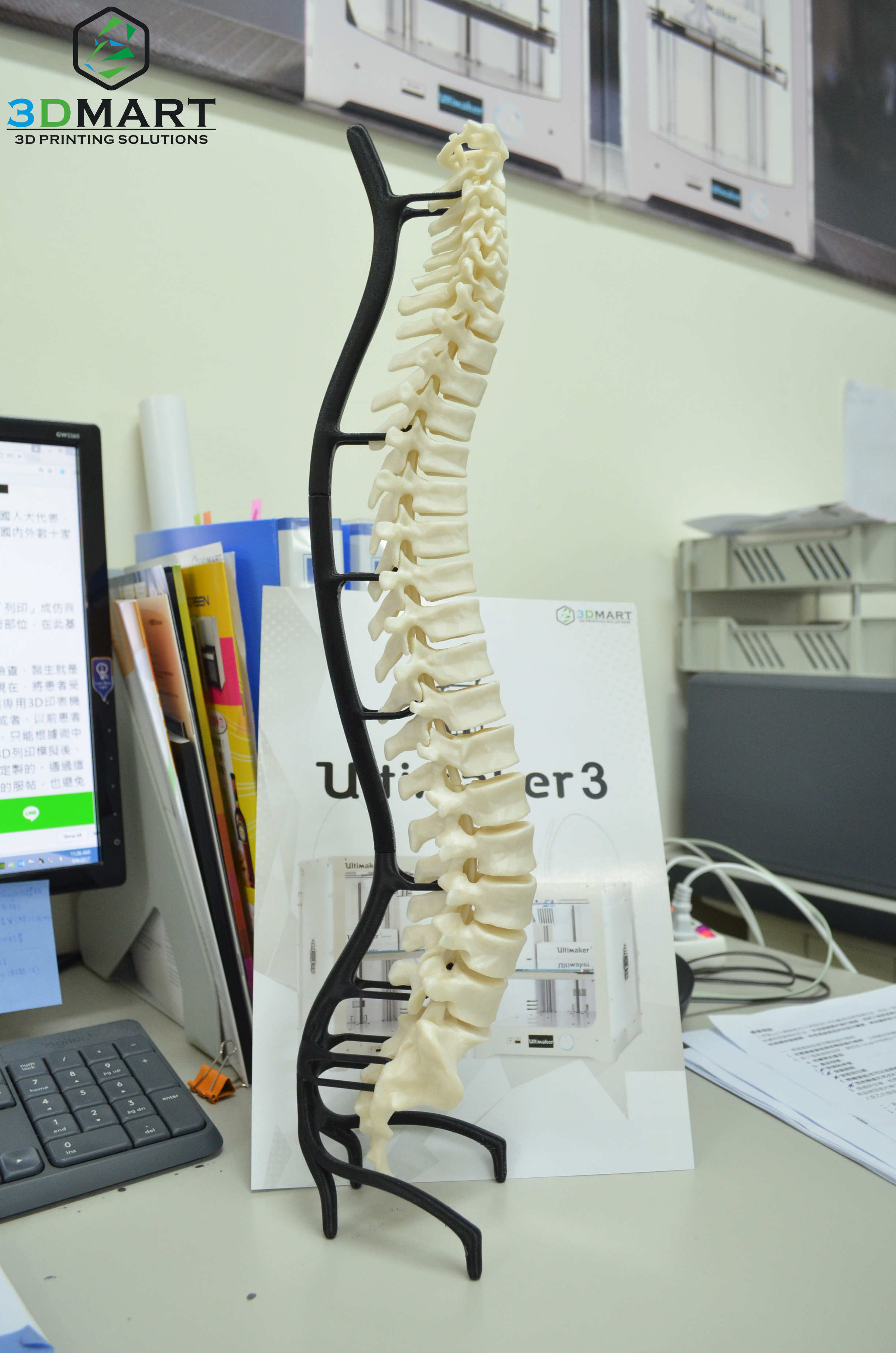 Ultimaker 3D列印機(jī)能夠醫(yī)療設(shè)備 Ultimaker 3D列印機(jī)能夠醫(yī)療設(shè)備